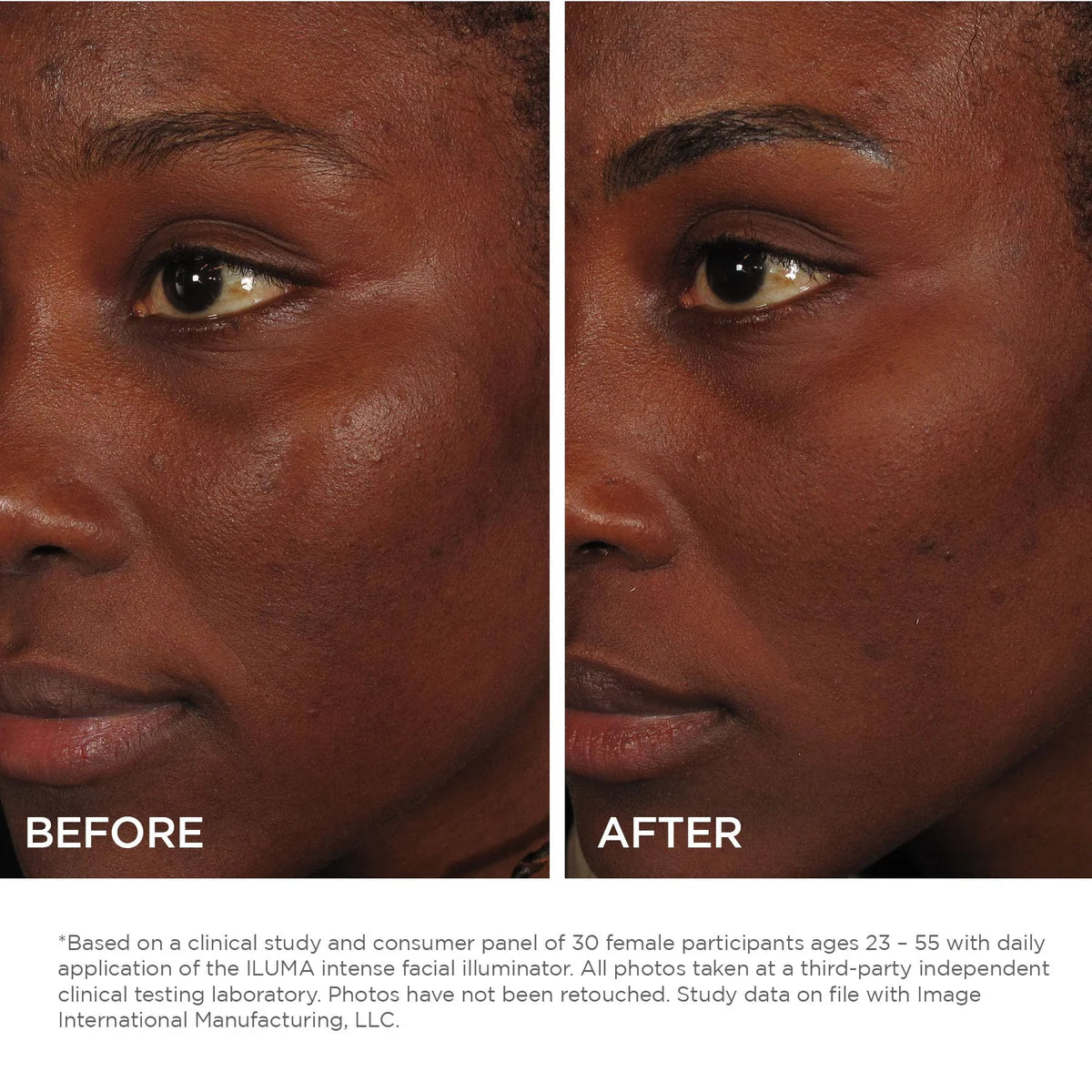 ILUMA INTENSE FACIAL ILLUMINATOR - Hidden Beauty
