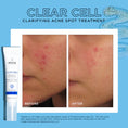 Load image into Gallery viewer, CLEAR CELL CLARIFYING SALICYLIC BLEMISH GEL
